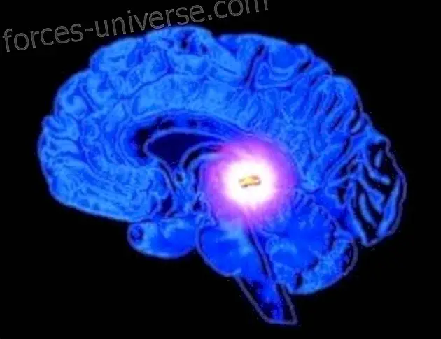 How to detoxify the pineal gland - Wisdom and knowledge
