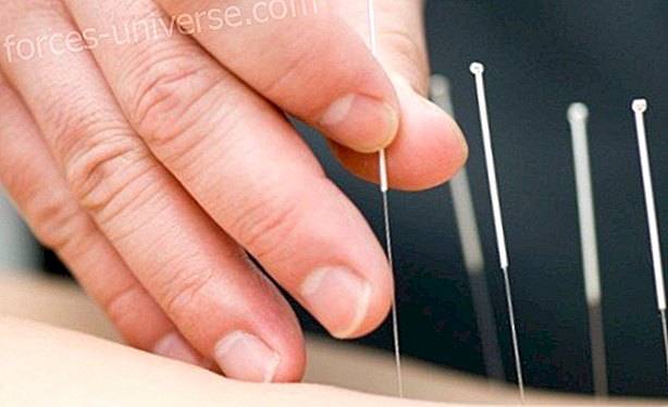 Acupuncture: The ancient technique of Traditional Chinese Medicine