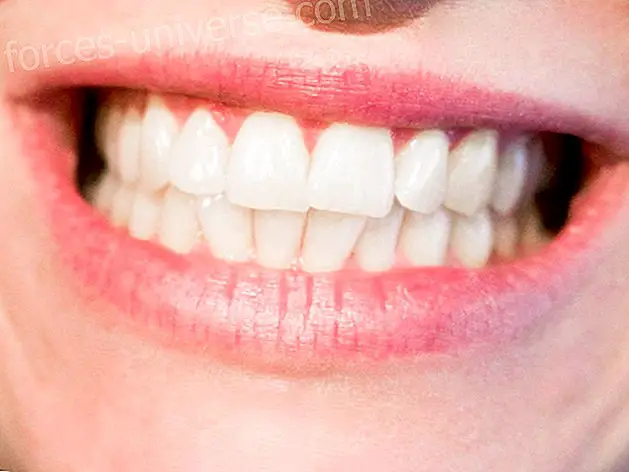 Cara menyembuhkan gigi berlubang, mencegahnya dan menjaga kesehatan mulut lebih sehat